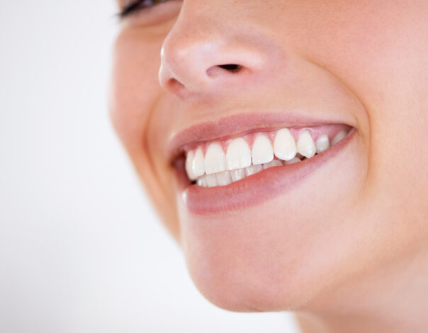 Woman smiling with teeth
